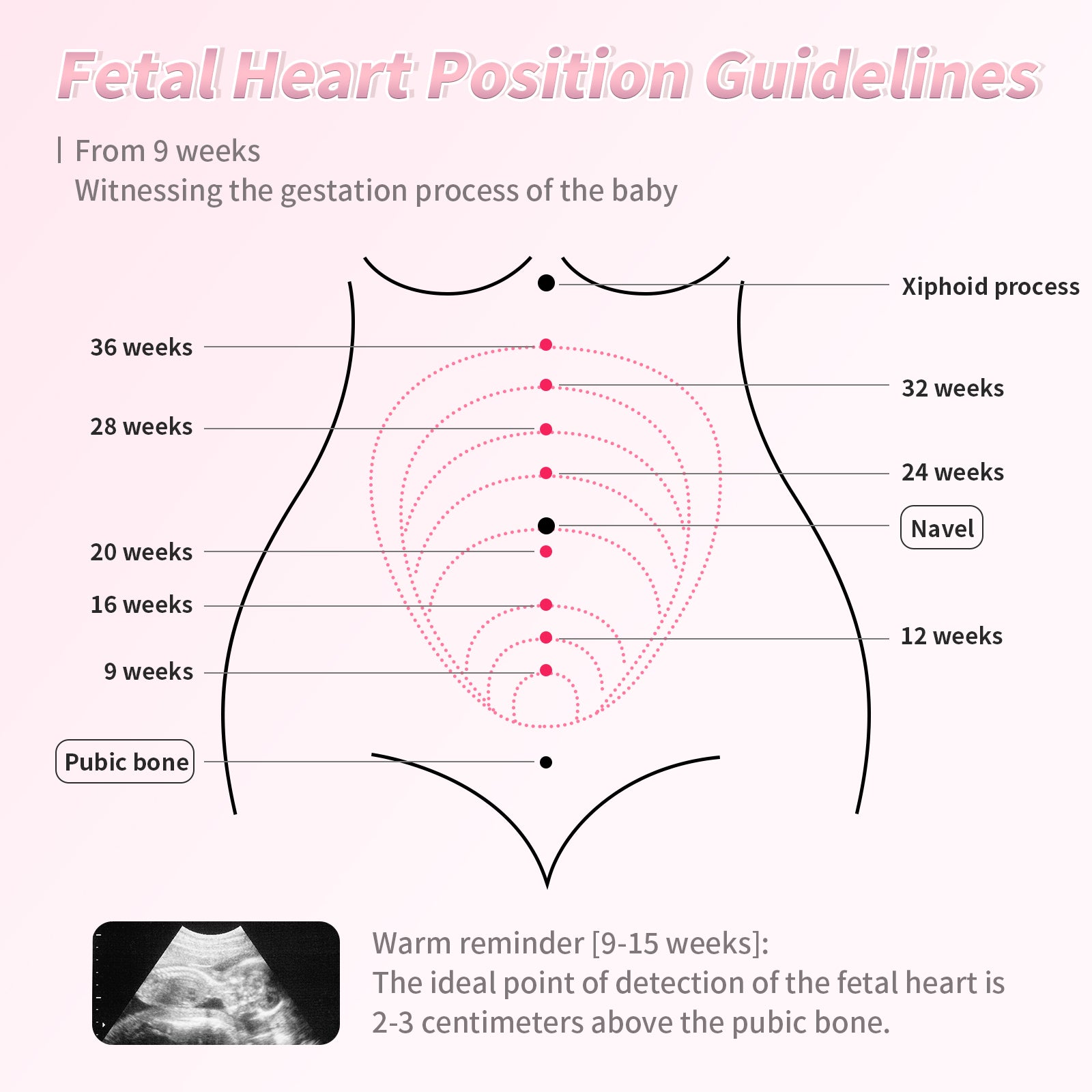Eovuox Fetal Doppler U6 - 25 - Eovuox